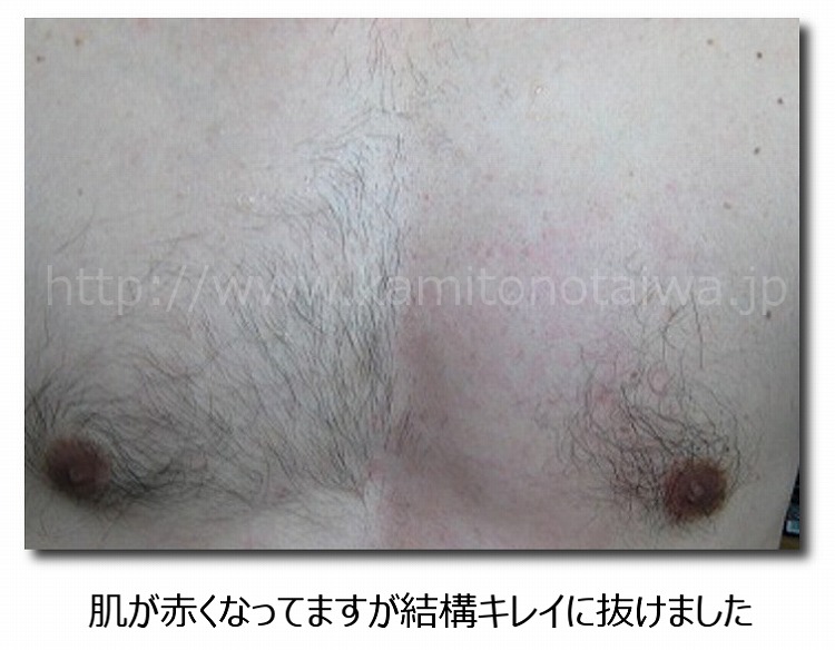 �E�у��b�N�X�ŋ��т̒E�ь���